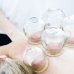 The Healing Art of Hijama (Cupping) Therapy